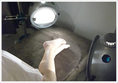 光線療法で体質を改善